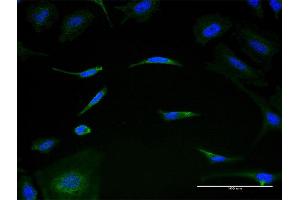 Immunofluorescence of monoclonal antibody to MRPL1 on HeLa cell.