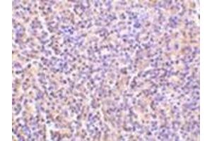 Immunohistochemistry of TCCR in human spleen tissue with this product at 5 μg/ml. (IL27 Receptor alpha anticorps  (C-Term))