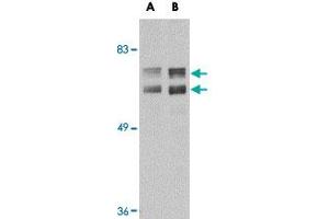 Western blot analysis of JPH2 in mouse brain tissue lysate with JPH2 polyclonal antibody  at (A) 1 and (B) 2 ug/mL . (Junctophilin 2 anticorps  (C-Term))