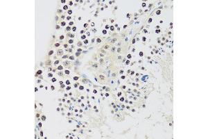 Immunohistochemistry of paraffin-embedded mouse testis using Cyclin E2 antibody (ABIN1679046, ABIN3018761, ABIN3018762 and ABIN6220571) at dilution of 1:100 (40x lens).
