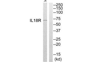 Western Blotting (WB) image for anti-Interleukin 1 Receptor Accessory Protein-Like 2 (IL1RAPL2) (Internal Region) antibody (ABIN1852568)