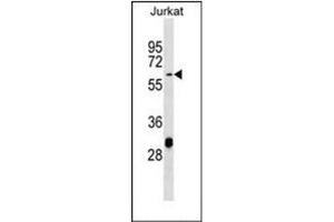 Western blot analysis of Matrilin-3 Antibody (Center) in Jurkat cell line lysates (35ug/lane).