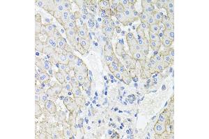 Immunohistochemistry of paraffin-embedded human liver injury using ATP1B1 antibody (ABIN5973412) at dilution of 1/100 (40x lens). (ATP1B1 anticorps)