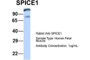 Host: Rabbit  Target Name: SPICE1  Sample Tissue: Human Fetal Muscle  Antibody Dilution: 1. (SPICE1 anticorps  (Middle Region))