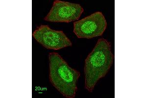 Immunofluorescent analysis of  cells, using FANCC Antibody (C-term) (ABIN653475 and ABIN2842896).