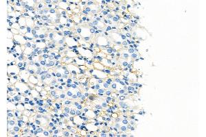 ABIN6260012 and ABIN6279137 at 1/100 staining Rat kidney tissue by IHC-P. (AQP6 anticorps  (Internal Region))