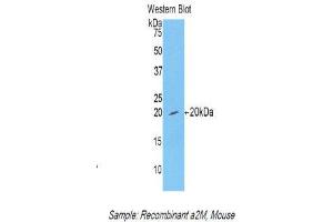 Western Blotting (WB) image for anti-alpha-2-Macroglobulin (A2M) (AA 1053-1214) antibody (ABIN1857846) (alpha 2 Macroglobulin anticorps  (AA 1053-1214))