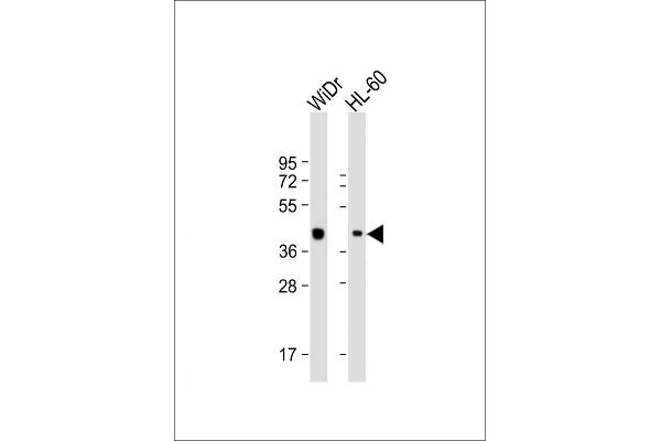 TFB2M anticorps  (C-Term)