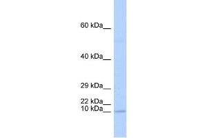 WB Suggested Anti-TAL2 Antibody Titration:  0. (TAL2 anticorps  (N-Term))