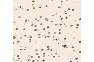 Immunohistochemistry of paraffin embedded mouse brain using SUPT3H (ABIN7075767) at dilution of 1: 1500 (400x lens) (SUPT3H/SPT3 anticorps)