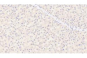 Detection of a2PI in Human Liver Tissue using Monoclonal Antibody to Alpha 2-Antiplasmin (a2PI) (a2PI anticorps)