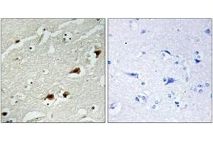 Immunohistochemistry analysis of paraffin-embedded human brain tissue, using NF-kappaB p65 (Ab-529) Antibody. (NF-kB p65 anticorps  (AA 496-545))