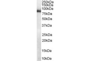 Western Blotting (WB) image for anti-Midline 2 (MID2) (C-Term) antibody (ABIN2465946) (Midline 2 anticorps  (C-Term))