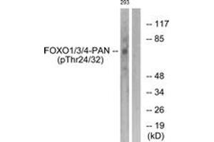 Western blot analysis of extracts from 293 cells treated with Serum 20% 15', using FOXO1/3/4-pan (Phospho-Thr24/32) Antibody. (FOXO1 anticorps  (pThr24))