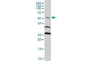 FOXC2 monoclonal antibody (M14), clone 4A3 Western Blot analysis of FOXC2 expression in PC-12 .