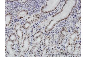 Immunoperoxidase of monoclonal antibody to BRD3 on formalin-fixed paraffin-embedded human stomach. (BRD3 anticorps  (AA 418-556))