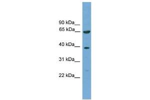 WB Suggested Anti-KLHL20  Antibody Titration: 0. (KLHL20 anticorps  (C-Term))