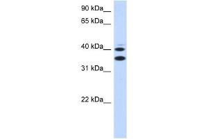 SLC25A32 antibody used at 1 ug/ml to detect target protein. (SLC25A32 anticorps  (Middle Region))