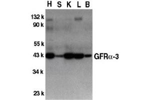 Western Blotting (WB) image for anti-GDNF Family Receptor alpha 3 (GFRA3) (Middle Region) antibody (ABIN1030939) (GFRA3 anticorps  (Middle Region))