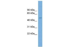 WB Suggested Anti-TRIM49 Antibody Titration: 0. (TRIM49 anticorps  (Middle Region))