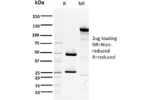 SDS-PAGE Analysis Purified ORC1 Mouse Monoclonal Antibody (7F6/1). (ORC1 anticorps)