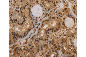 Immunohistochemistry (IHC) image for anti-Potassium Intermediate/small Conductance Calcium-Activated Channel, Subfamily N, Member 4 (KCNN4) antibody (ABIN2434884)