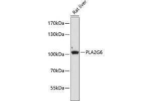 Western blot analysis of extracts of rat liver, using PLG6 antibody (ABIN6134886, ABIN6145732, ABIN6145733 and ABIN6225021) at 1:1000 dilution.