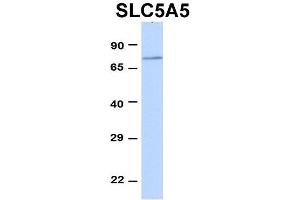 Host:  Rabbit  Target Name:  SLC5A5  Sample Type:  293T  Antibody Dilution:  1. (SLC5A5 anticorps  (Middle Region))