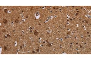 Immunohistochemistry of paraffin-embedded Mouse brain using MYCN Polyclonal Antibody at dilution 1:35 (MYCN anticorps)