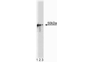Western blot analysis of Dynactin p50 on Jurkat cell lysate. (Dynamitin anticorps  (AA 55-196))