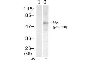 Image no. 2 for anti-Myc Proto-Oncogene protein (MYC) (pThr358) antibody (ABIN196675) (c-MYC anticorps  (pThr358))