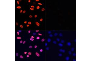 Immunofluorescence analysis of HeLa cells using Acetyl-Histone H3-K9 antibody (ABIN7267675) at dilution of 1:100 (40x lens).
