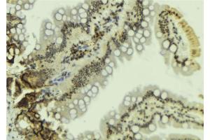 ABIN6269115 at 1/100 staining Mouse colon tissue by IHC-P.