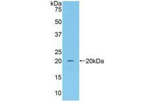Western blot analysis of recombinant Mouse CAT. (Catalase anticorps  (AA 80-239))