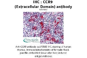 Image no. 1 for anti-Chemokine (C-C Motif) Receptor 9 (CCR9) (2nd Extracellular Domain) antibody (ABIN1732788) (CCR9 anticorps  (2nd Extracellular Domain))