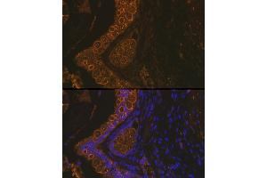 Immunofluorescence analysis of Rat rectum using Cytokeratin 18 (KRT18) antibody (ABIN7268097) at dilution of 1:100. (Cytokeratin 18 anticorps)