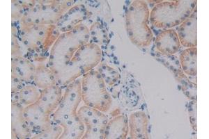 DAB staining on IHC-P; Samples: Human Kidney Tissue