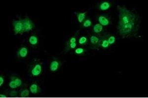 Anti-LOX mouse monoclonal antibody (ABIN2453810) immunofluorescent staining of COS7 cells transiently transfected by pCMV6-ENTRY LOX (RC213323). (LOX anticorps  (AA 22-168))