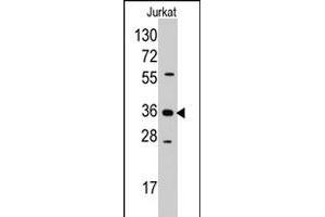 Western blot analysis of AKR1B1 polyclonal antibody  in Jurkat cell line lysates (35 ug/lane). (AKR1B1 anticorps  (Internal Region))