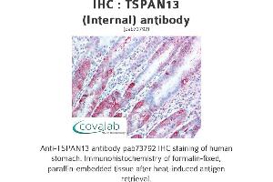 Image no. 2 for anti-Tetraspanin 13 (TSPAN13) (Internal Region) antibody (ABIN1740424)