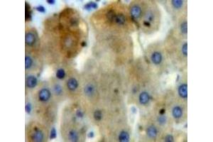 IHC-P analysis of Liver tissue, with DAB staining. (EPYC anticorps  (AA 110-317))