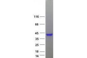 Validation with Western Blot