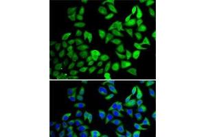 Immunofluorescence analysis of A-549 cells using USP8 Polyclonal Antibody (USP8 anticorps)