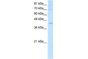 NXF5 antibody used at 2. (NXF5 anticorps  (Middle Region))