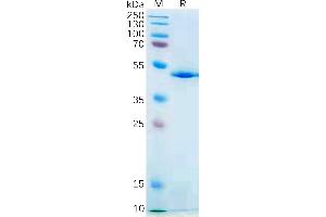 Human IL21 Protein, hFc Tag on SDS-PAGE under reducing condition.