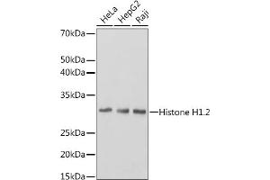 Western blot analysis of extracts of various cell lines, using Histone H1.