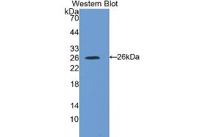 Western Blotting (WB) image for anti-Suppressor of Cytokine Signaling 3 (SOCS3) (AA 1-225) antibody (ABIN3206237) (SOCS3 anticorps  (AA 1-225))
