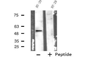 Western blot analysis of extracts from HT-29 cells, using ADRB1 antibody. (ADRB1 anticorps  (Internal Region))