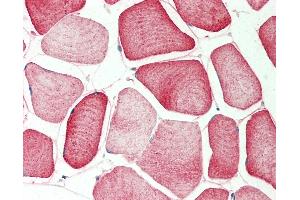 Human Skeletal Muscle: Formalin-Fixed, Paraffin-Embedded (FFPE).