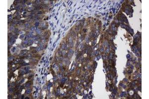 anti-TSC22 Domain Family, Member 1 (TSC22D1) antibody